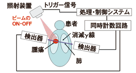 図1　開発中の放射線治療システムの概念図