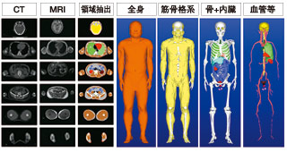 図1　人体モデルの構築