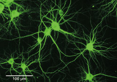 図1  ネットワークを形成したニューロンの顕微鏡写真（薬品で着色）