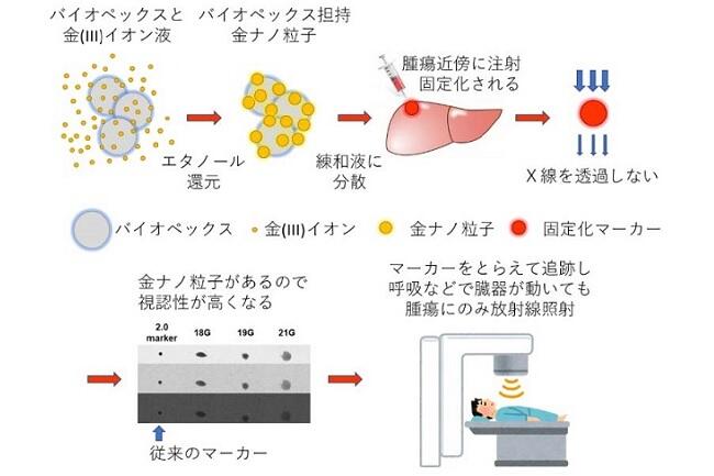 低侵襲の留置が可能なX線マーカーの開発に初めて成功～より多くの患者さんへのがん放射線治療の適応に期待～