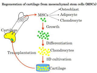 Regenerating cartilage from bone marrow mesenchymal stem cells