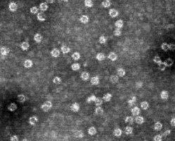 Norovirus VLP electron microscope image